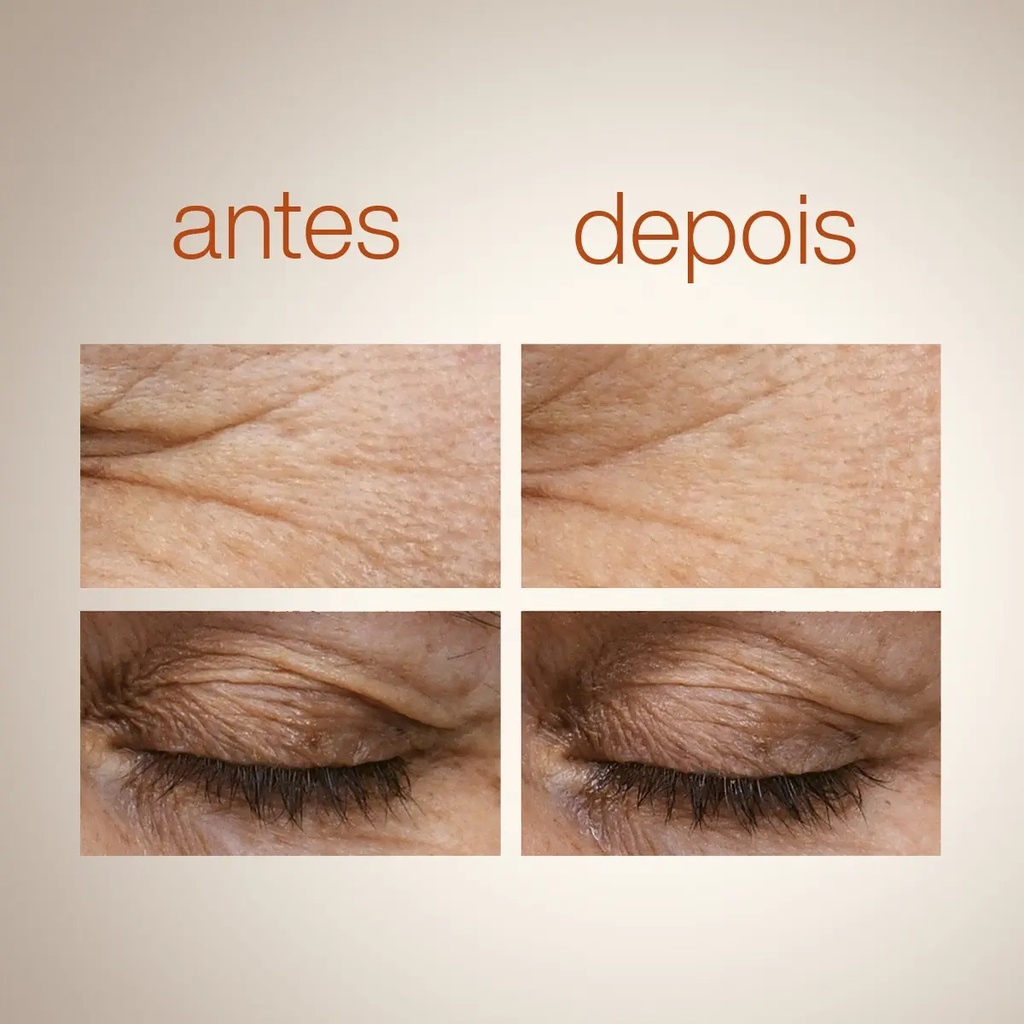 Sérum De Ojos Superreductor De Arrugas Natura Chronos Todo Tipo De Piel Día/noche